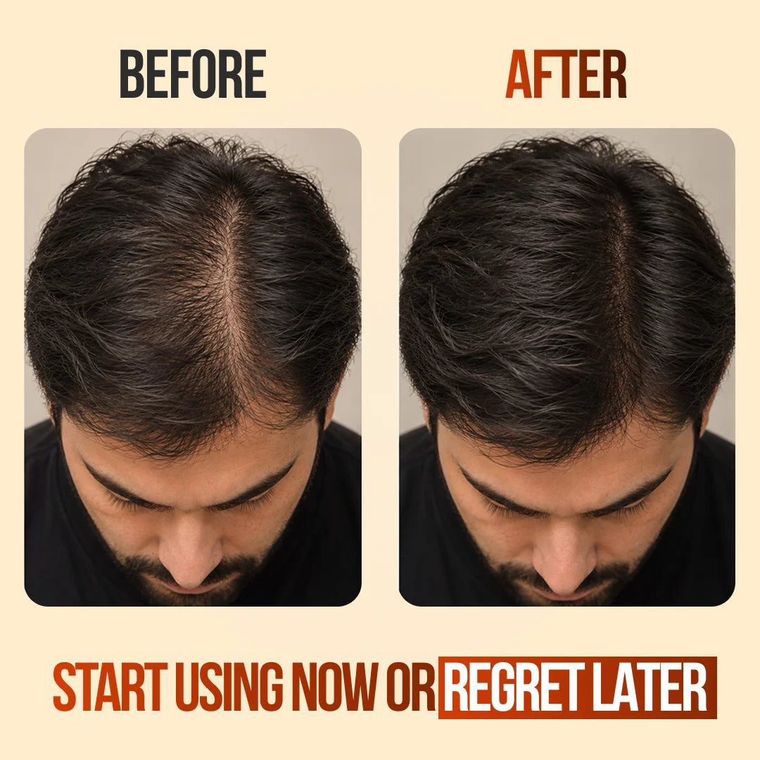 Bioblas Anti-Hair Loss Energy Shampoo (Caffeine + Ginseng)