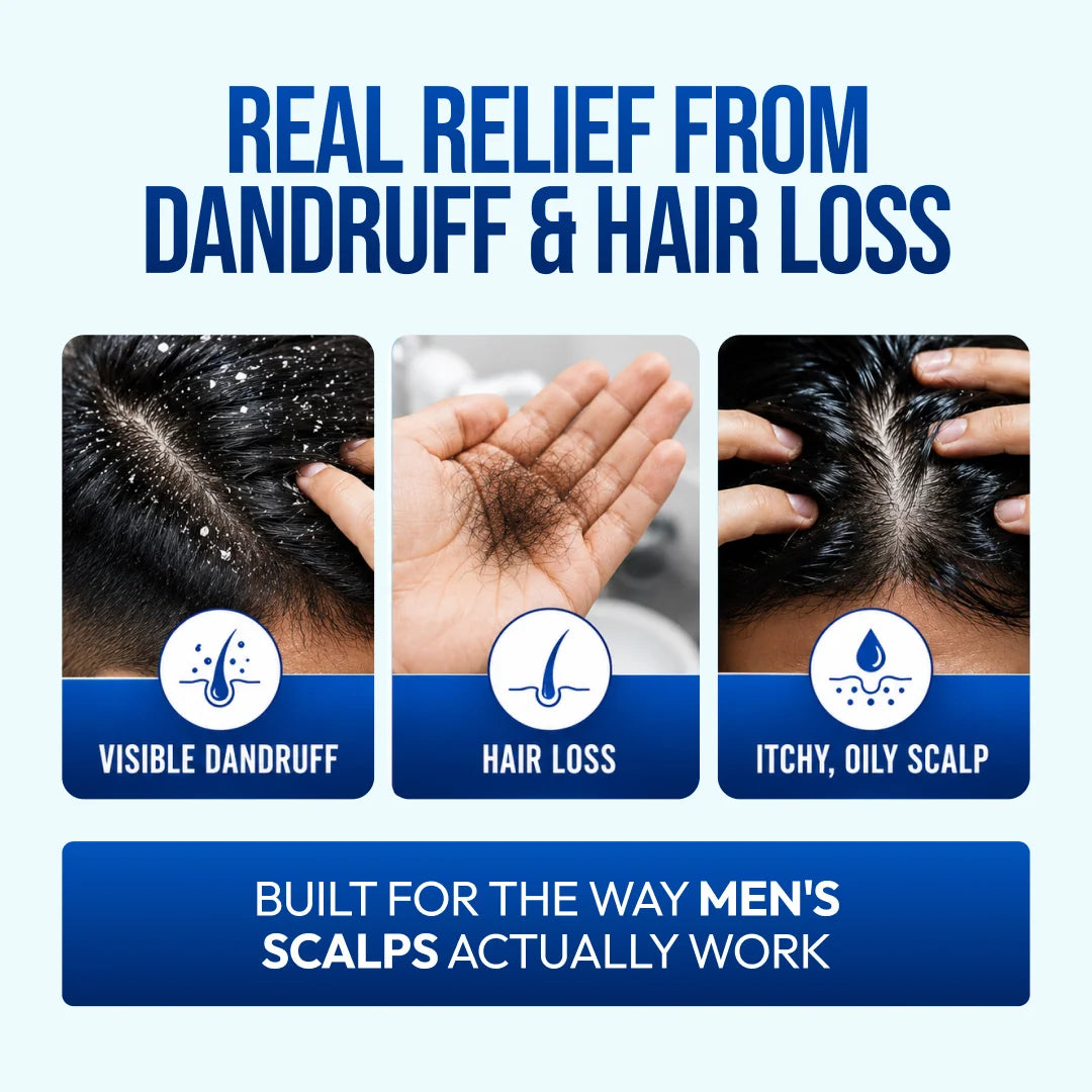 Bioblas For Men Anti-Dandruff & Hair Loss Shampoo (Menthol & Complex B19)